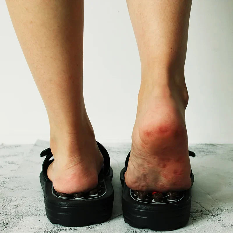 Acupressure Massage Slippers — Reflexology Foot Relief for Tired, Aching Feet