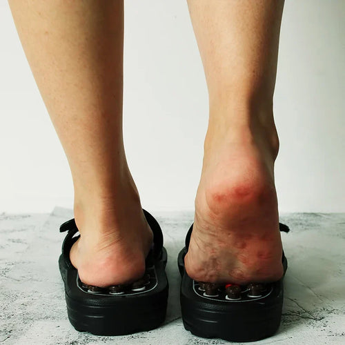 Acupressure Massage Slippers — Reflexology Foot Relief for Tired, Aching Feet